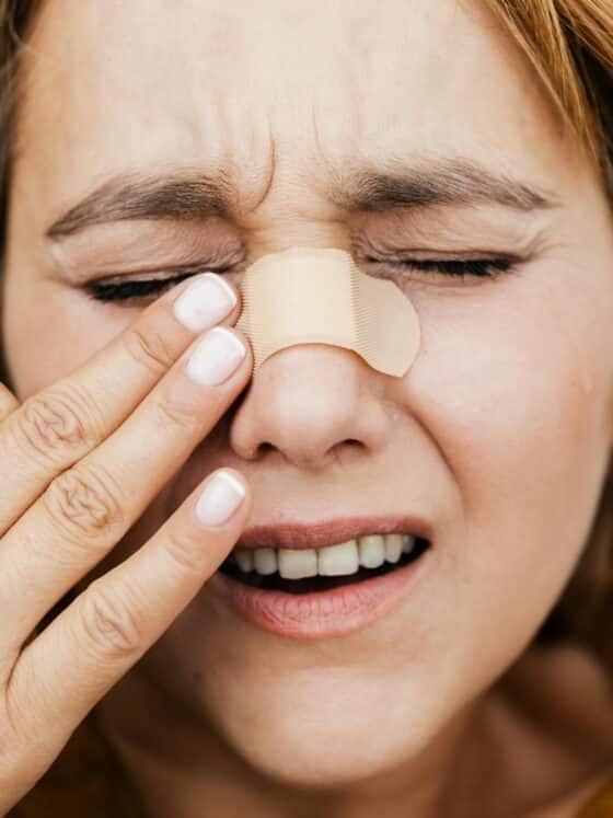 face injury