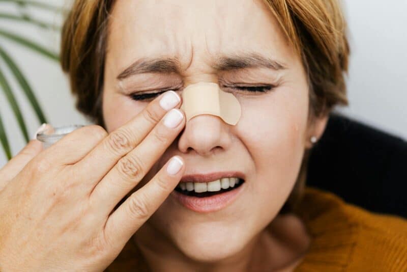 face injury