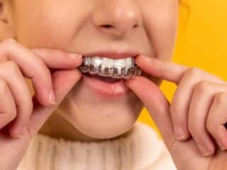 teeth aligner