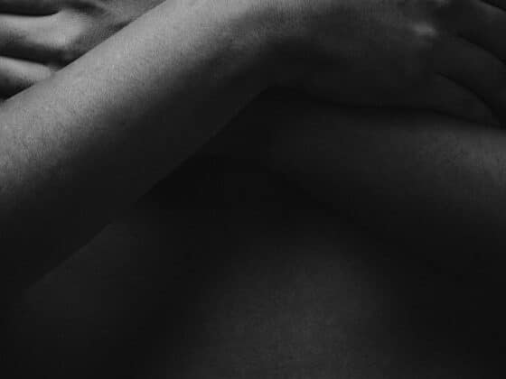 mastectomy