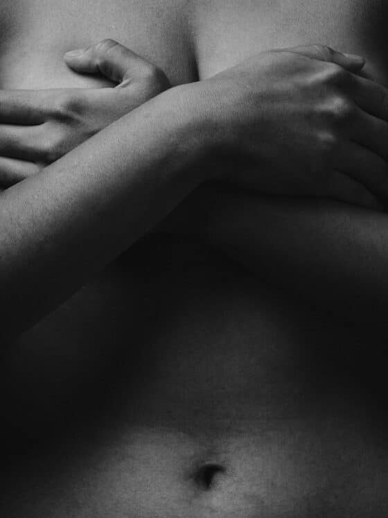 mastectomy