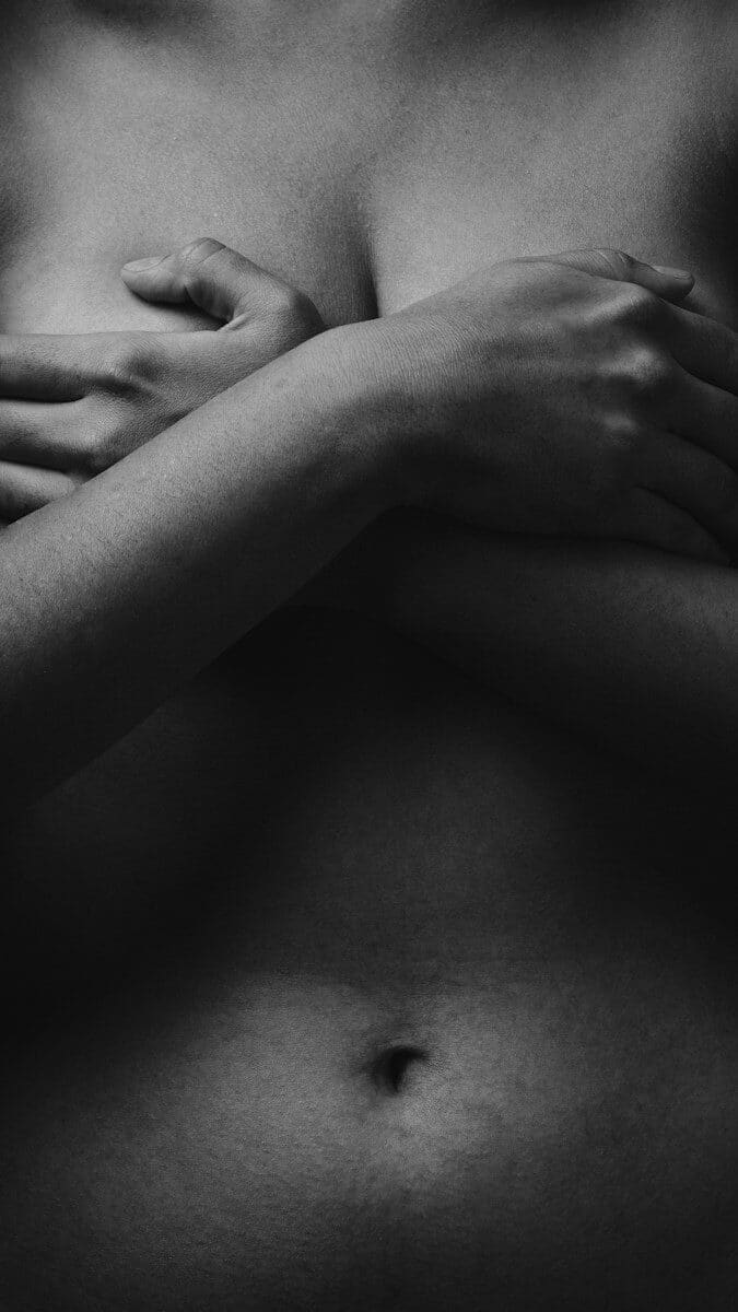 mastectomy